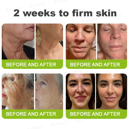 🍁👨‍⚕️Made and shipped from Canada 💫Rolimey® Botox & Vita-A Retinol Shot Wrinkle-Lift Tightening cream - Last Day Promotion 70% OFF
