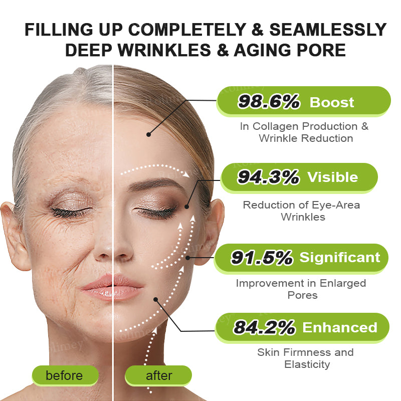 🍁👨‍⚕️Made and shipped from Canada 💫Rolimey® Botox & Vita-A Retinol Shot Wrinkle-Lift Tightening cream - Last Day Promotion 70% OFF