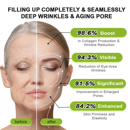 🍁👨‍⚕️Made and shipped from Canada 💫Rolimey® Botox & Vita-A Retinol Shot Wrinkle-Lift Tightening cream - Last Day Promotion 70% OFF
