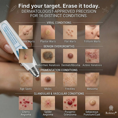🏆🇨🇦 Official Canada Store | Rolimey® 7-Day Skin Tag & Blemish Roll-On – Painless & Scar-Free