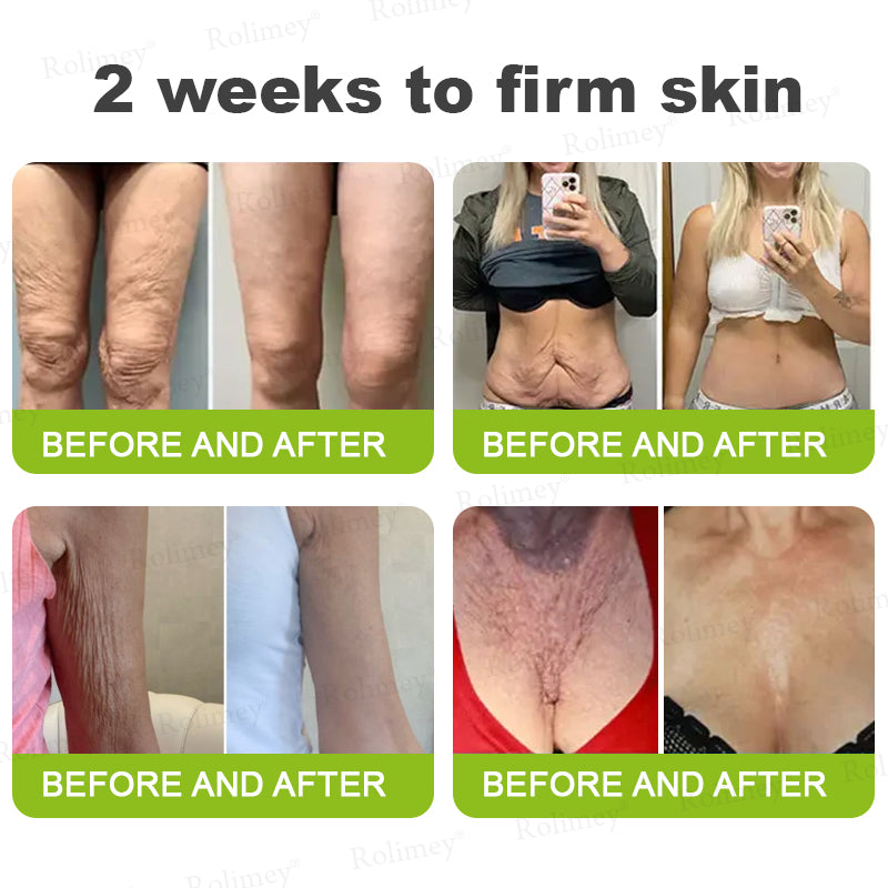 🍁👨‍⚕️Made and shipped from Canada 💫Rolimey® Botox & Vita-A Retinol Shot Wrinkle-Lift Tightening cream - Last Day Promotion 70% OFF