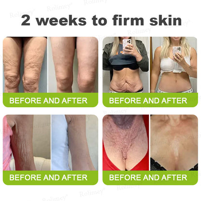 🍁👨‍⚕️Made and shipped from Canada 💫Rolimey® Botox & Vita-A Retinol Shot Wrinkle-Lift Tightening cream - Last Day Promotion 70% OFF