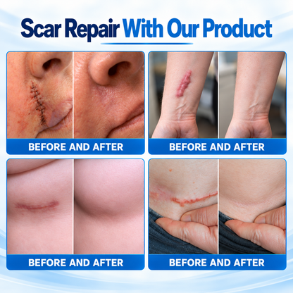 Dr.Fachmer® 👩‍⚕️Bio-Regenerative Micro-Needle Scar Removal Patch –Repair Protein Silicone Scar Care