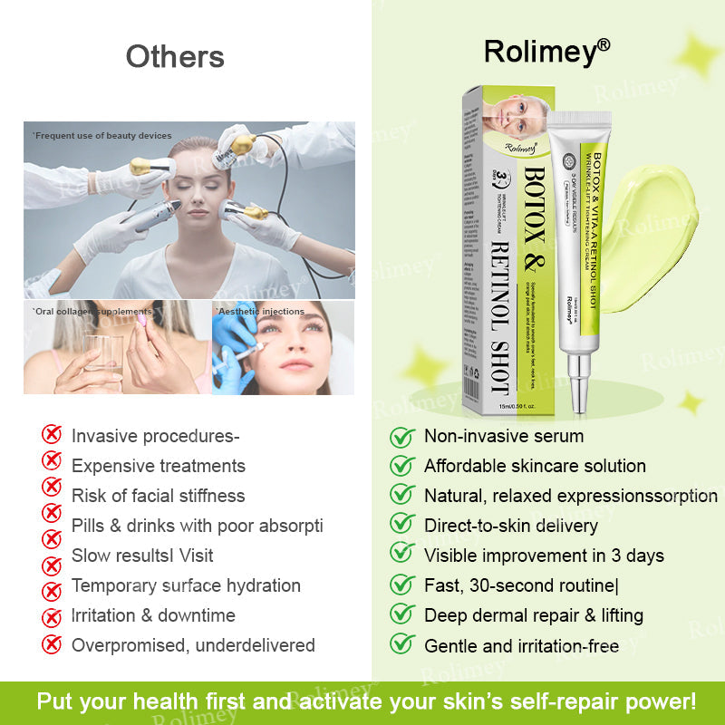 🍁👨‍⚕️Made and shipped from Canada 💫Rolimey® Botox & Vita-A Retinol Shot Wrinkle-Lift Tightening cream - Last Day Promotion 70% OFF