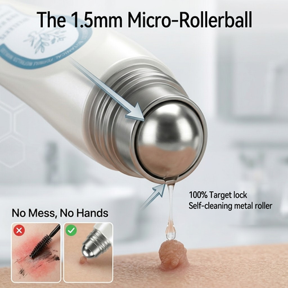 🏆🇨🇦 Official Canada Store | Rolimey® 7-Day Skin Tag & Blemish Roll-On – Painless & Scar-Free